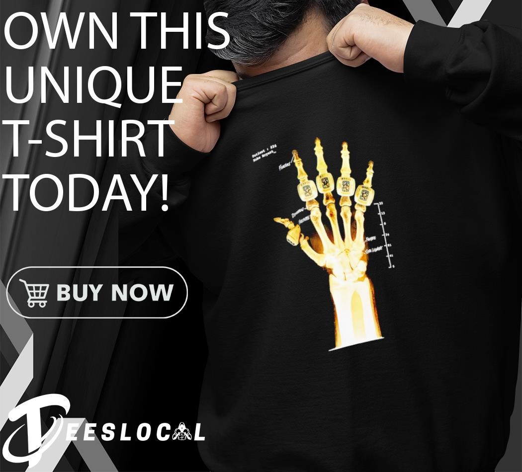 broken not beaten kobe